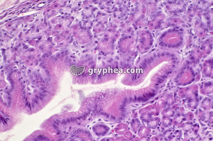 Estomac pylorique x160 - gryphea.org